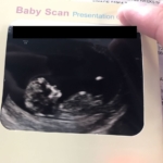 Blogger 12 week pregnancy scan